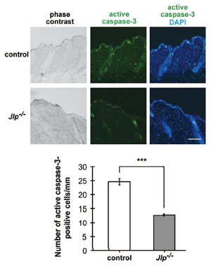 紫外線誘導性アポトーシスにおける足場タンパク質JLPの役割
