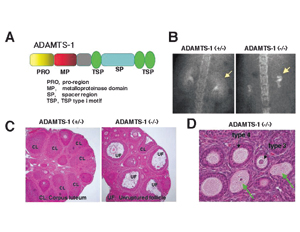 ADAMTS-1遺伝子欠損マウスの腎臓，卵巣における異常。