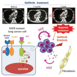 Molecular mechanism by which HGF induces resistance to gefitinib in EGFR mutant lung cancer