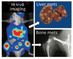 In vivo imaging of multiple-organ metastasis