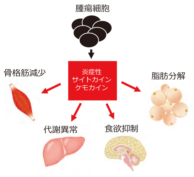 図1　がん悪液質の発生機序